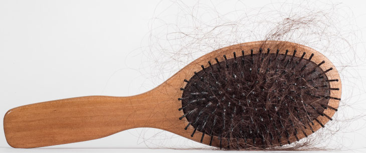 hair loss chicago dermatology
