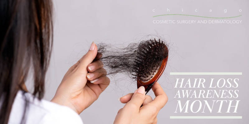 August is Hair Loss Awareness Month