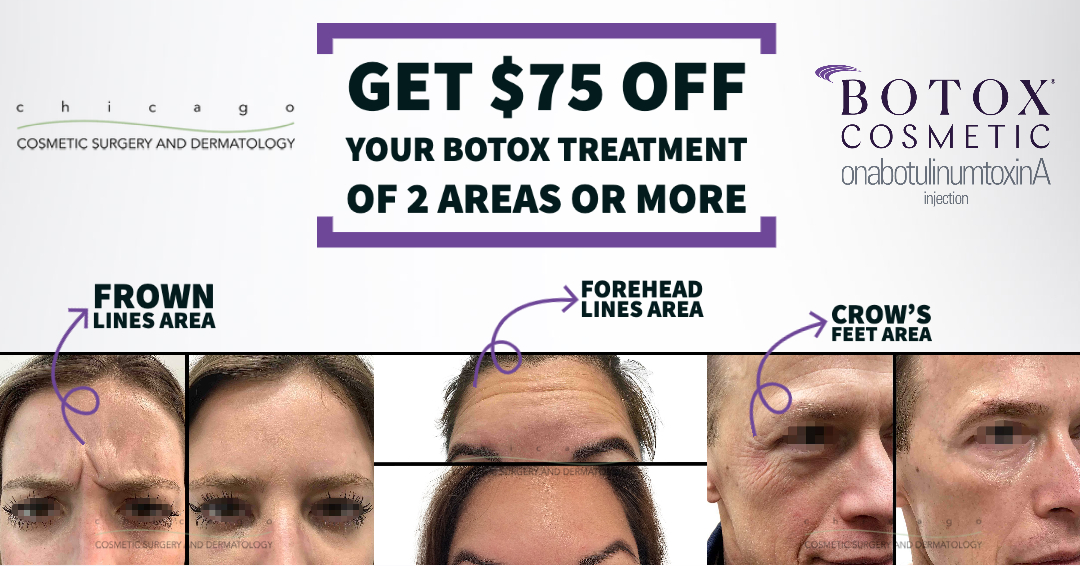 Botox flash sale until August 31st!