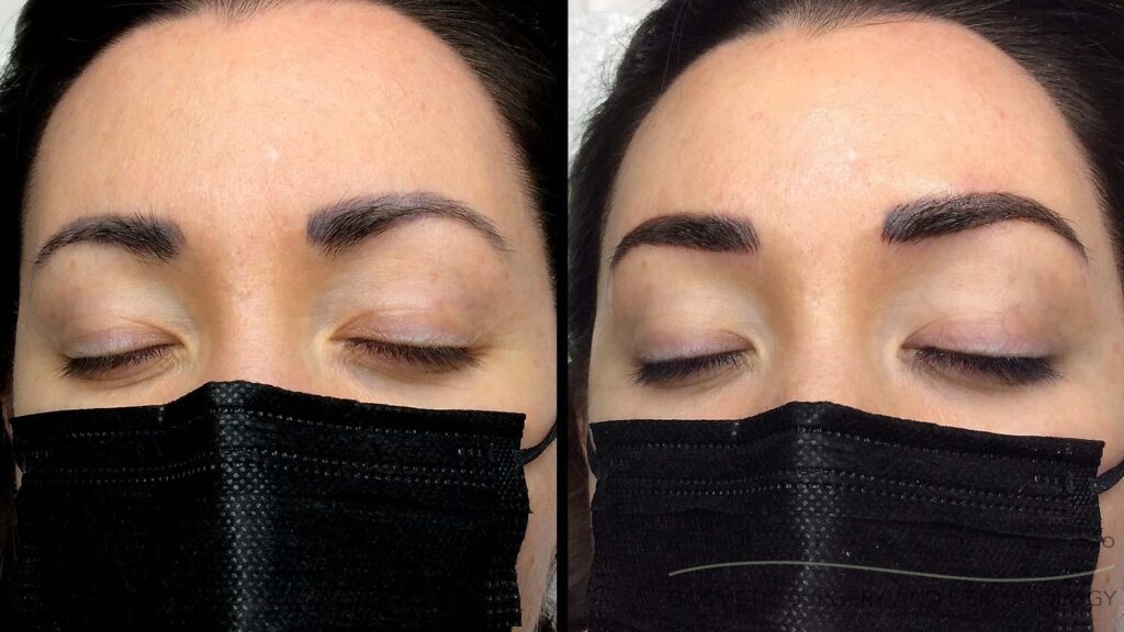 Permanent Makeup Chicago Cosmetic