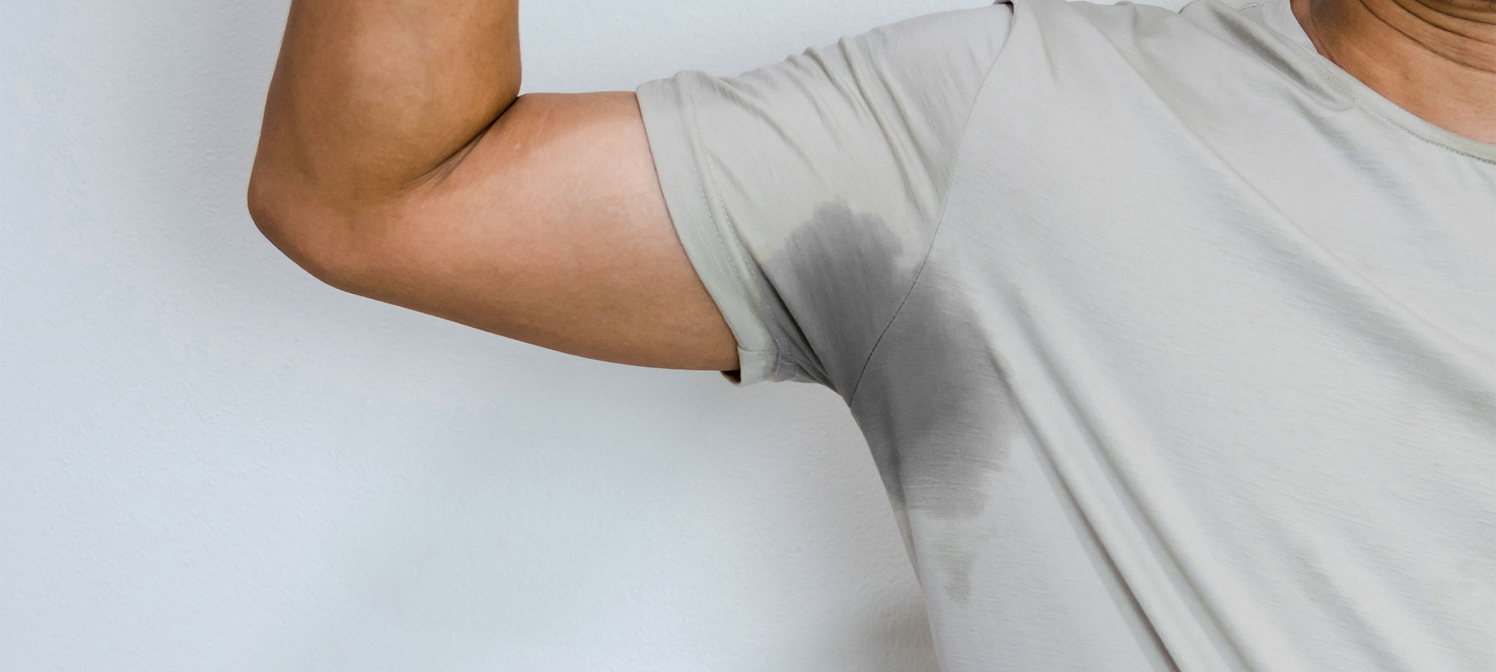 Excessive Sweating Treatment – Chicago Hyperhidrosis Treatments