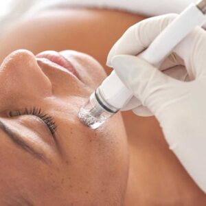 diamondglow microdermabrasion